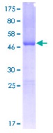 SDS-PAGE FXN-4576H.jpg